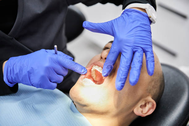 Best Knocked-Out Tooth (Avulsed Tooth) Treatment in Woodsboro, MD